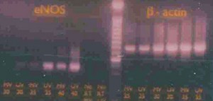 Homepage-Image-3-RT-PCR-jpeg-high-web